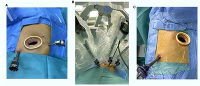 Comparison of perioperative outcomes between robotic-assisted and video-assisted thoracoscopic surgery for mediastinal masses in patients with different body mass index ranges: A population-based study